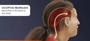 Occipital Headache Can Be Cured With Gelsemium