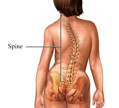 Scoliosis can be cured with Homeopathic Remedy Silicea